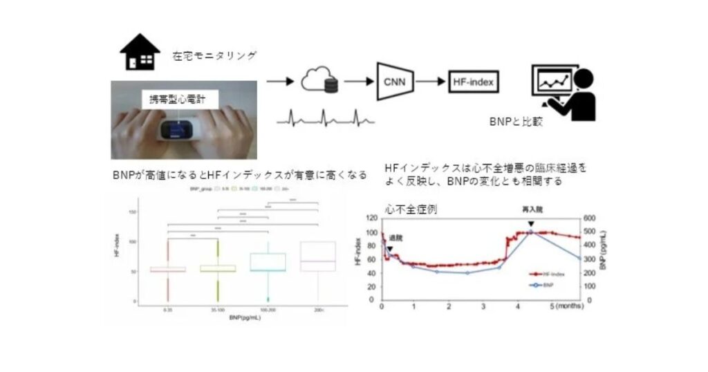 家庭で心不全の悪化を早期発見　AIが重症度を数値化、在宅モニタリングの新時代へ