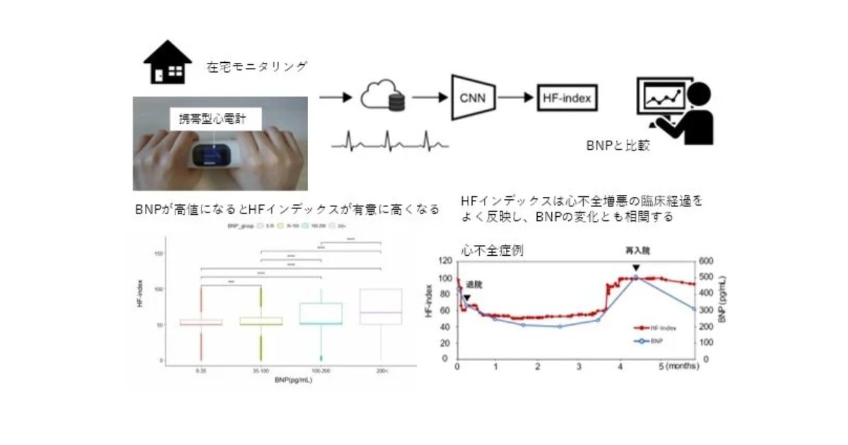 家庭で心不全の悪化を早期発見　AIが重症度を数値化、在宅モニタリングの新時代へ